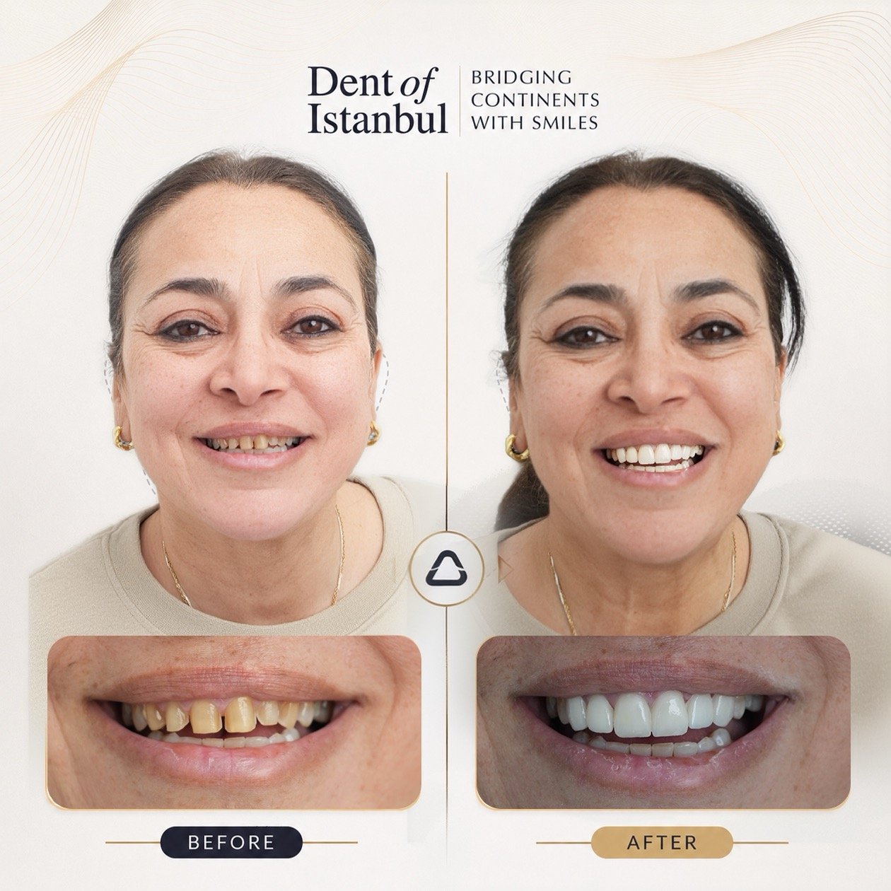 Salma Before and After